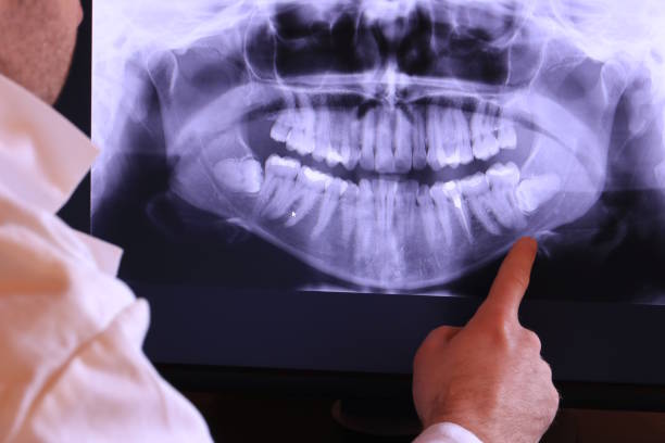 Best Chipped Tooth Repair Near Me  in Williamston, SC